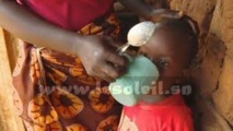 malnutrition